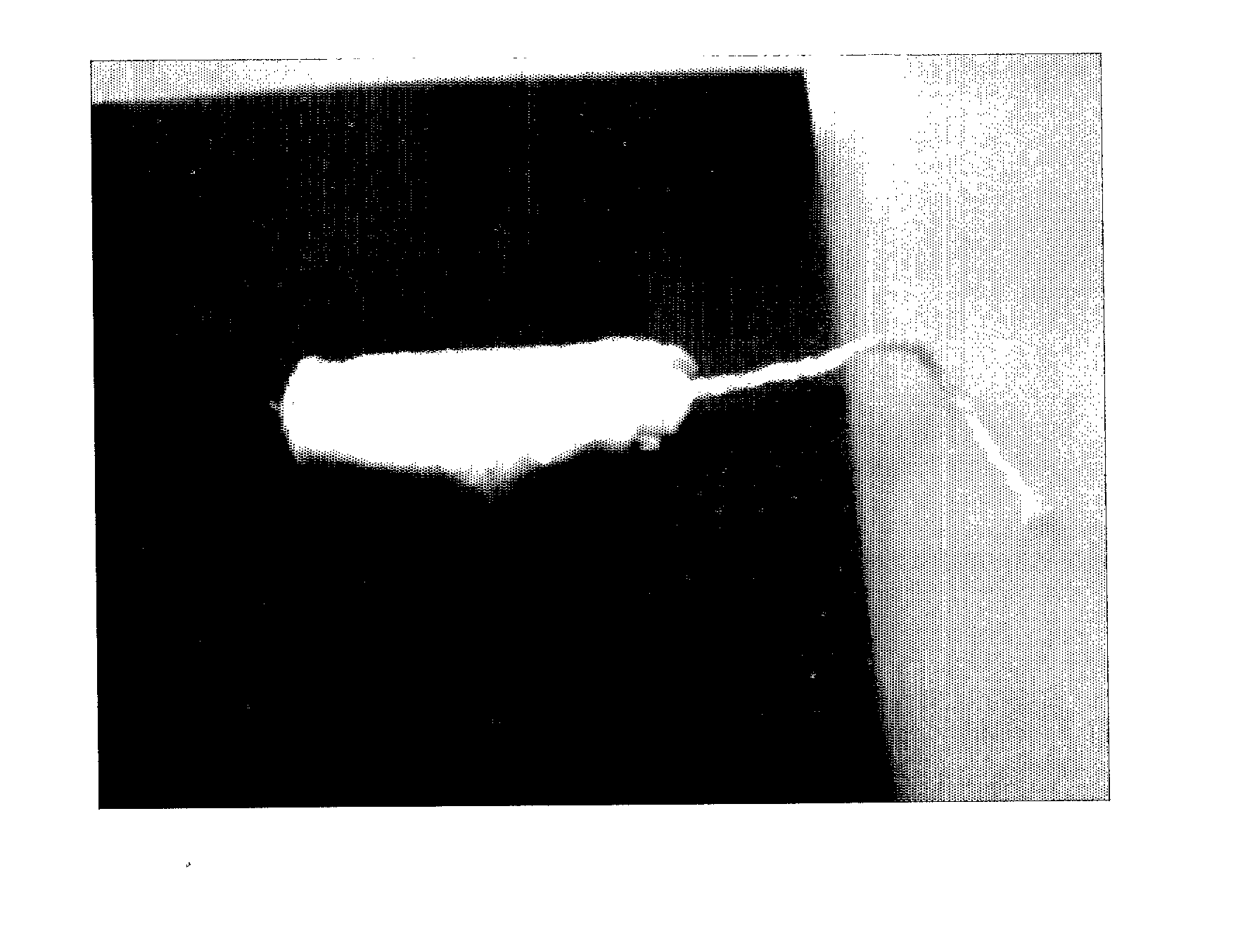 Device for in situ production and topical administration of allicin