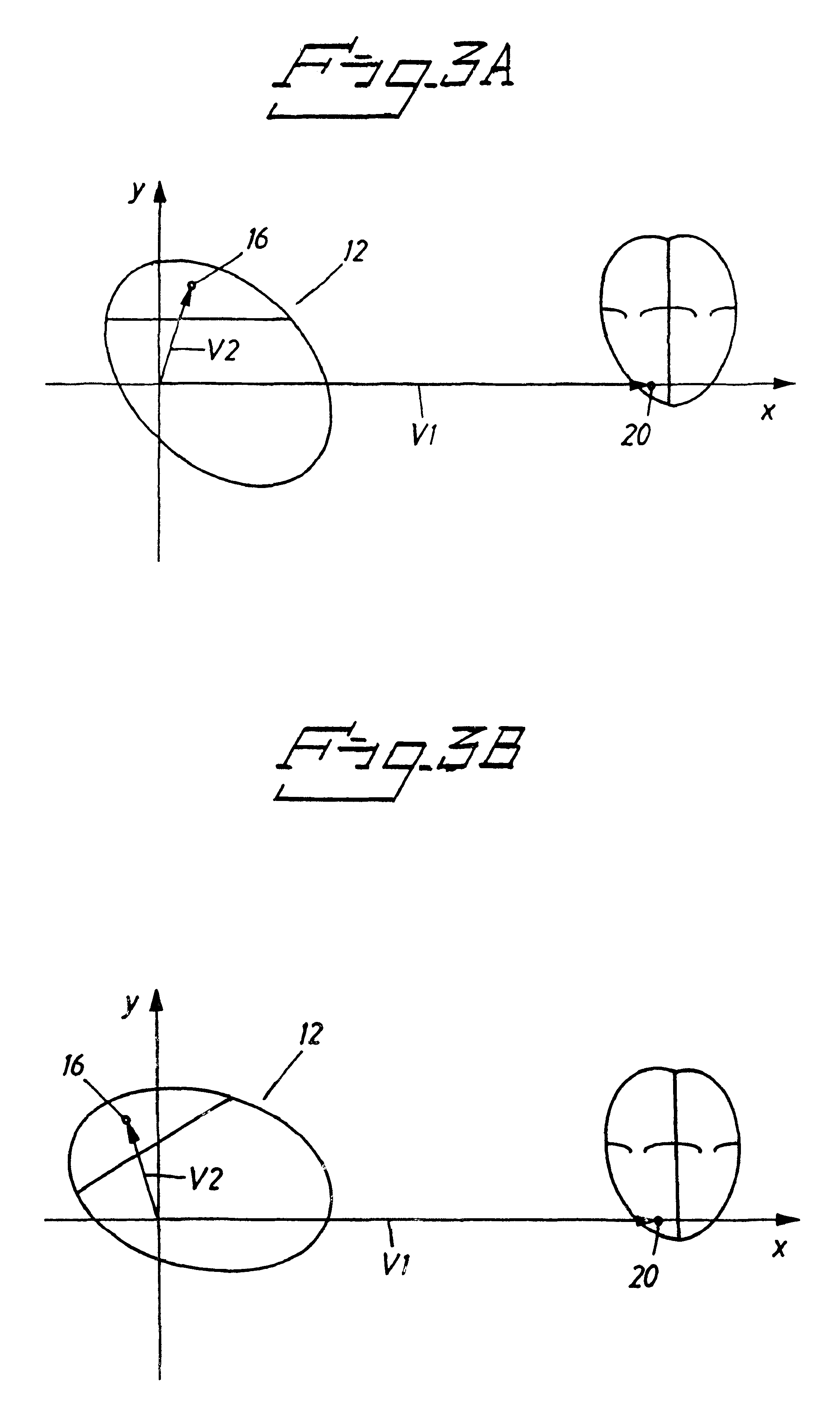 Implantable cardiac stimulator with circuitry for removing noise in sensed electrical signals