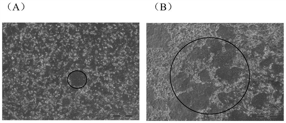 Primary hepatoma carcinoma cell culture medium, primary hepatoma carcinoma cell culture method and application