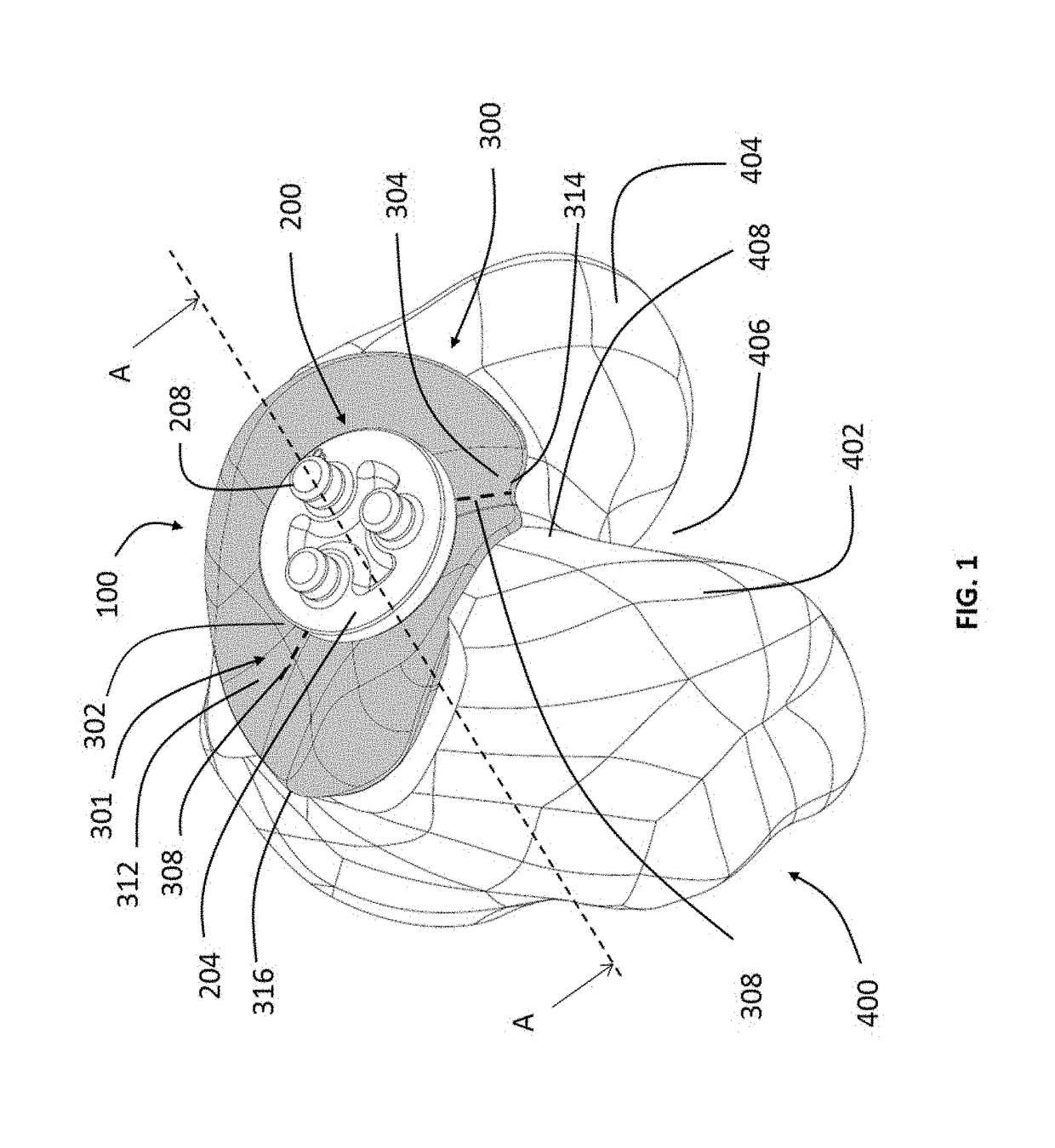 Patellofemoral implant