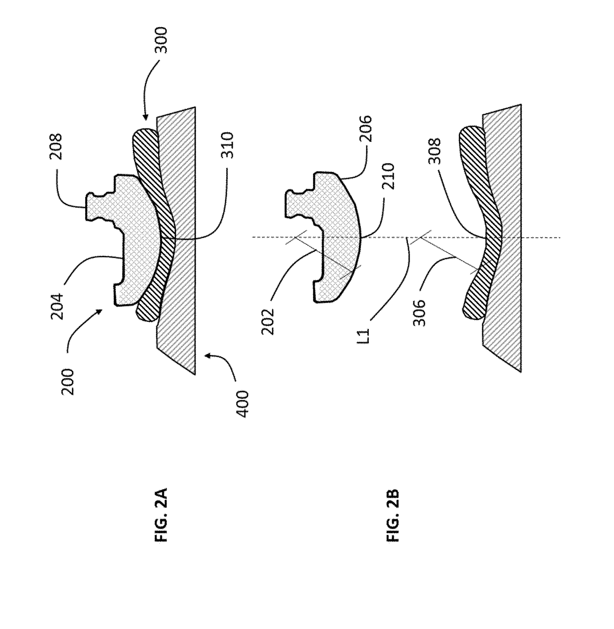 Patellofemoral implant