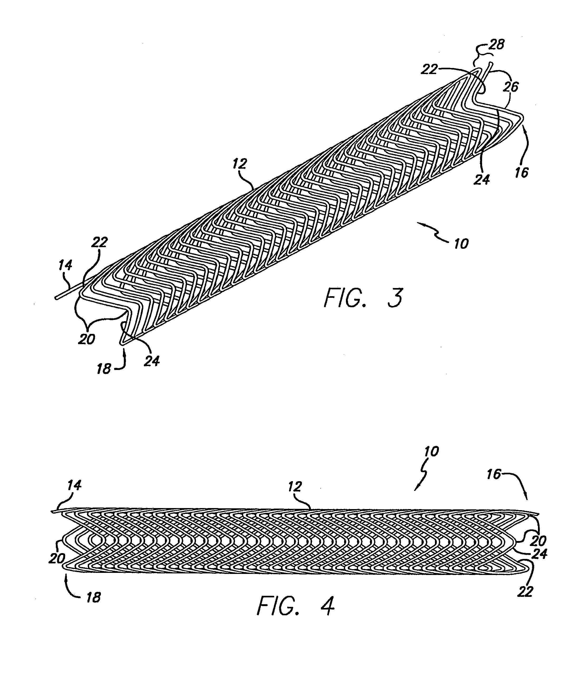 Intravascular Flow Modifier And Reinforcement Device And Deployment System For Same