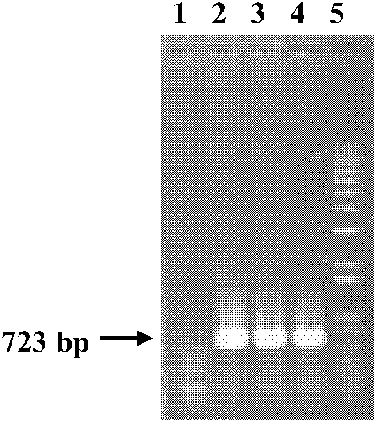 Vitreoscilla hemoglobin vgbS nucleotide sequence and plasmid and preparation method thereof