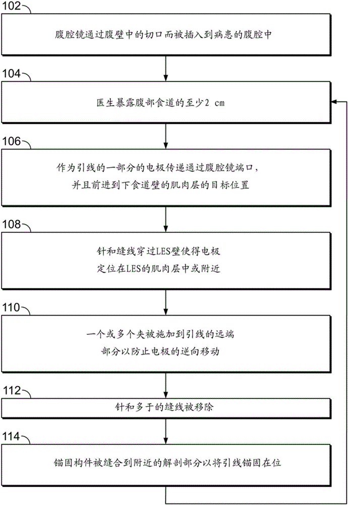 Lead implantation method