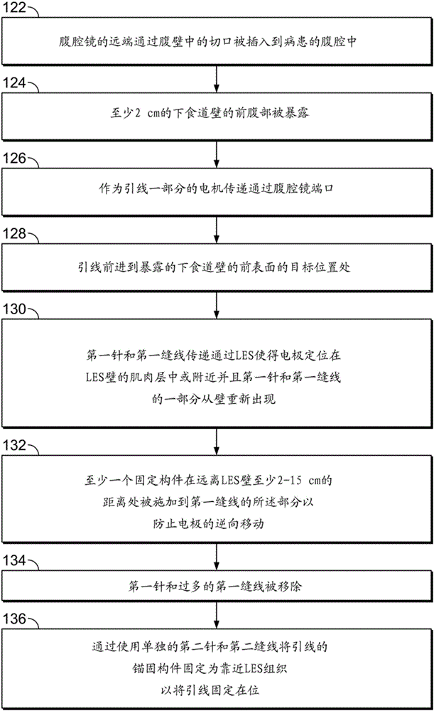 Lead implantation method