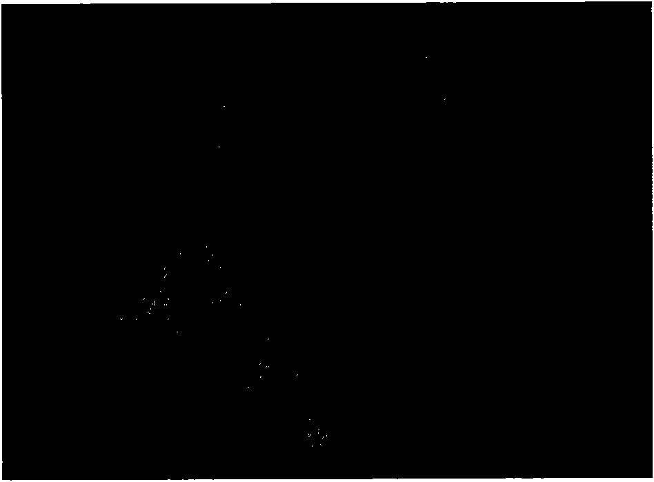 Application of 5'-AMP for treating urarthritis