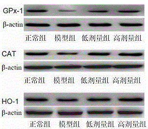 Traditional Chinese medicine composition for treating parkinson disease