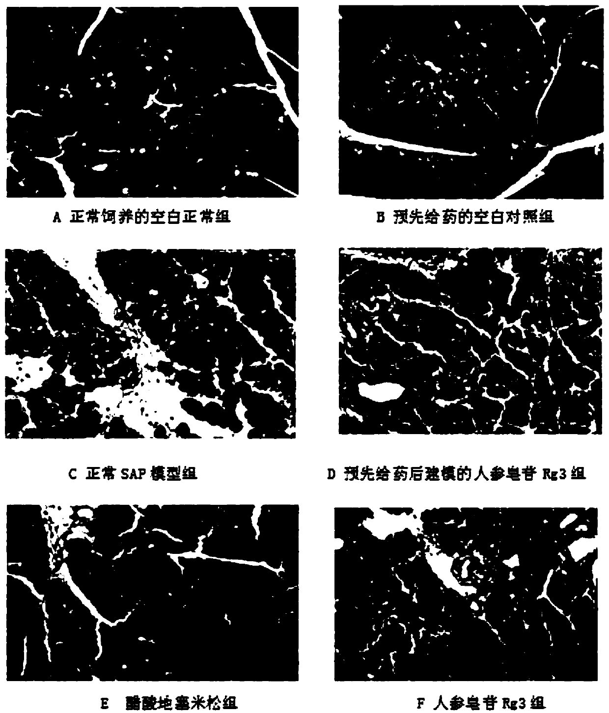 Application of ginsenoside Rg3 in preparing drug for preventing and/or treating severe acute pancreatitis