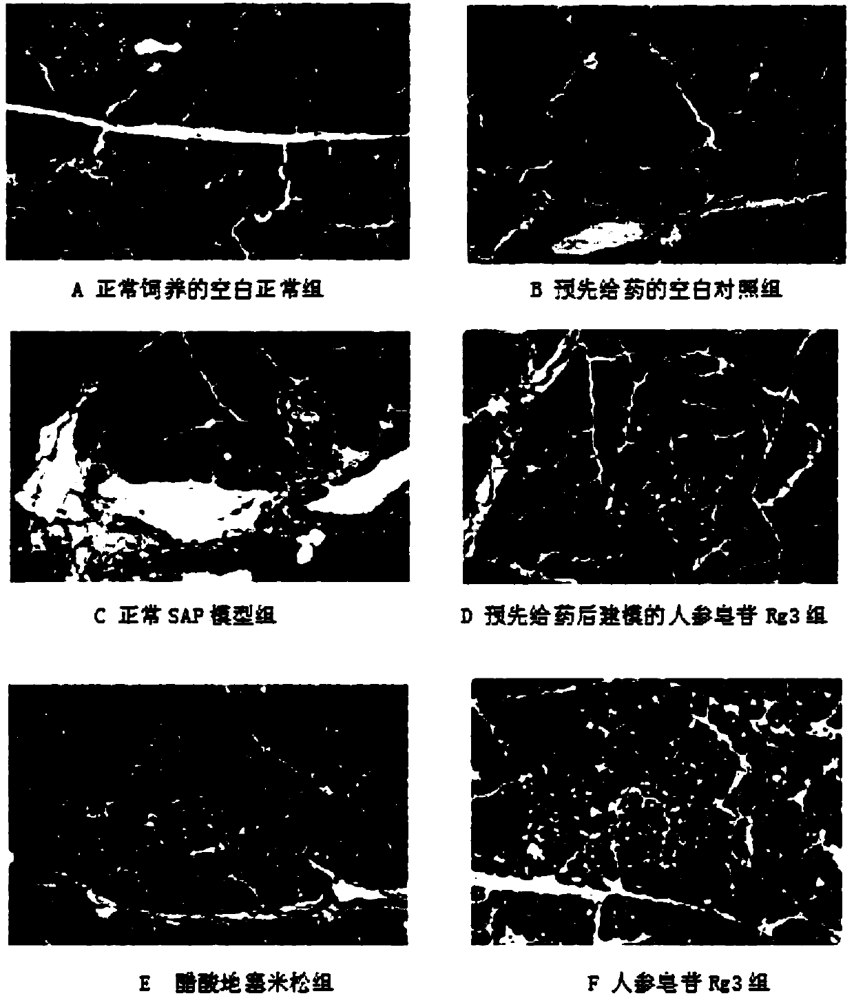 Application of ginsenoside Rg3 in preparing drug for preventing and/or treating severe acute pancreatitis