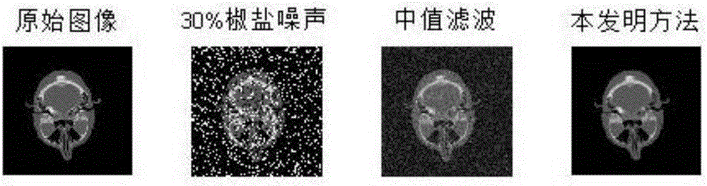 Improved adaptive weighted average image denoising method based on extreme learning machine