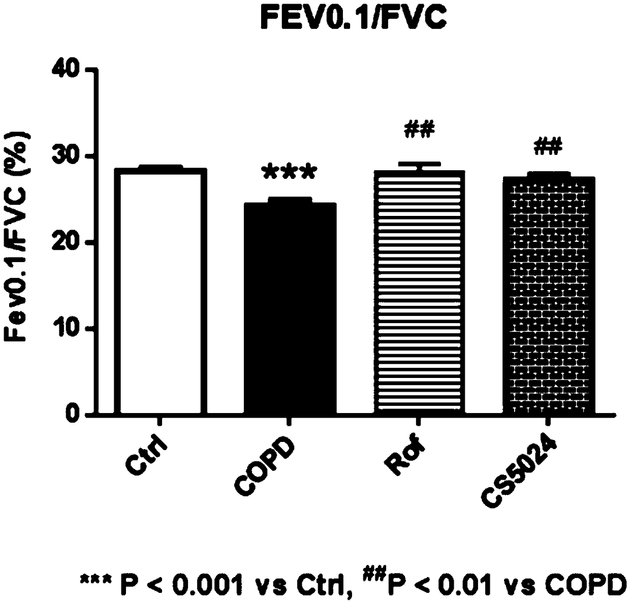 Applications of P2X3 acceptor conditioning agent benzimidazole compound in preparation of medicines used for treating respiratory diseases