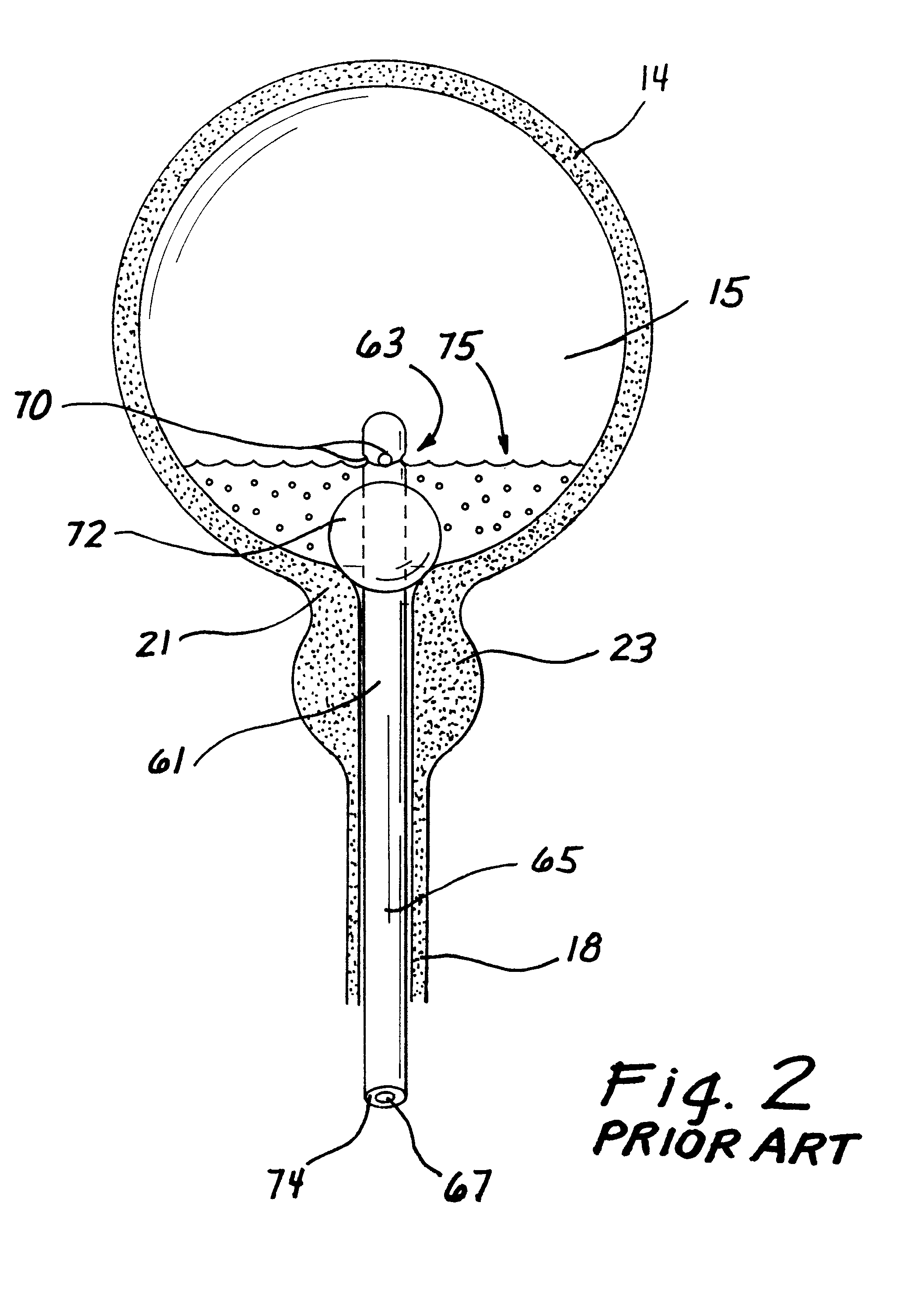 Drainage catheter