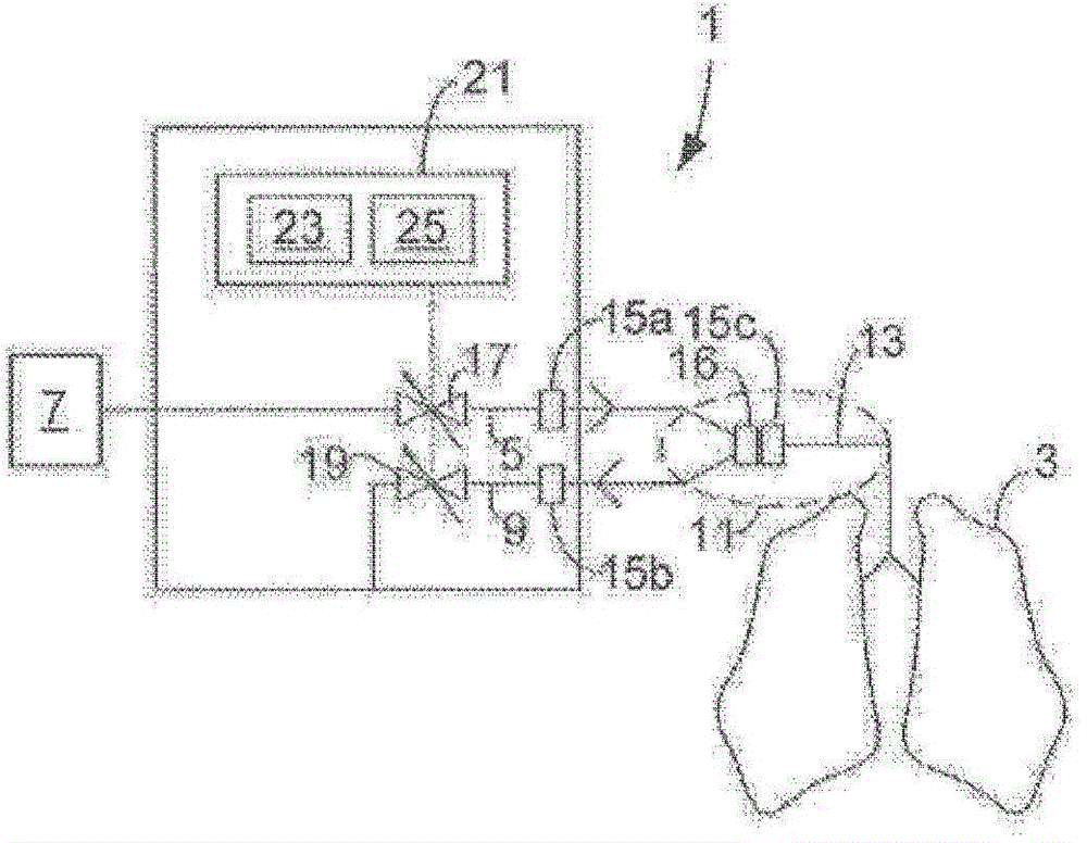 Valve controlled high frequency oscillatory ventilation