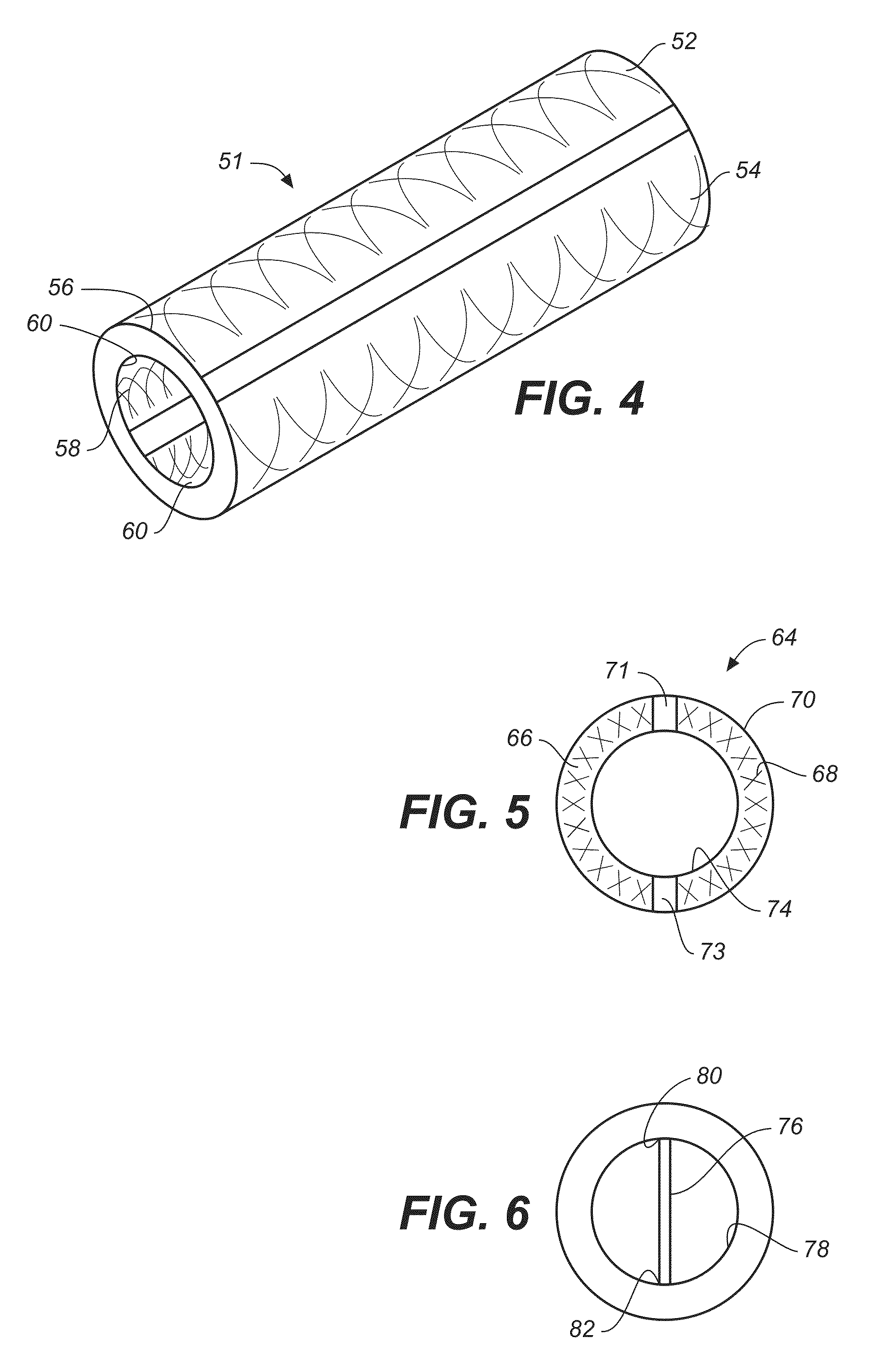 Electrochemical disinfection of implanted catheters