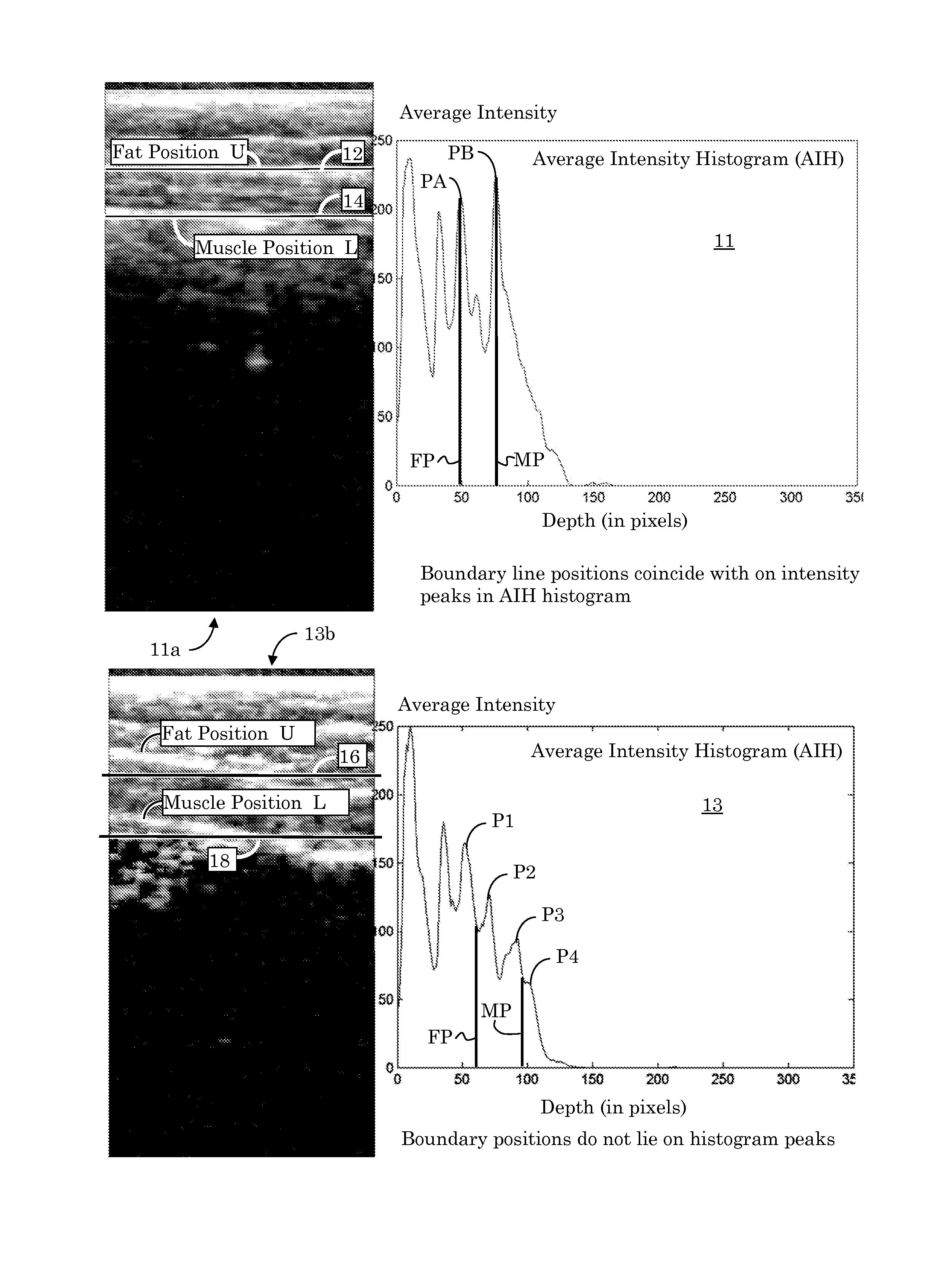 Ultrasound Image Object Boundary Localization by Intensity Histogram Classification Using Relationships Among Boundaries