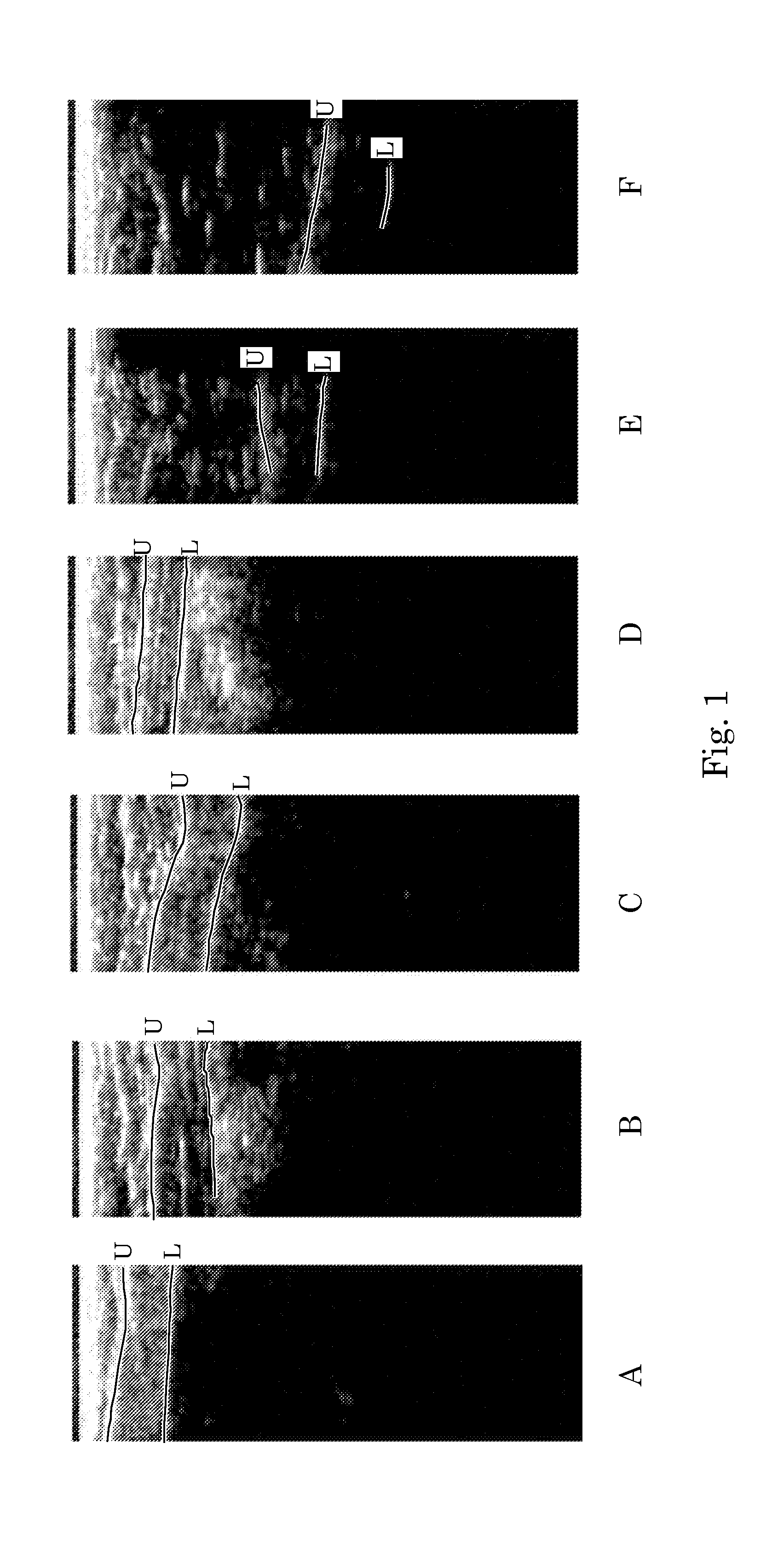 Ultrasound Image Object Boundary Localization by Intensity Histogram Classification Using Relationships Among Boundaries