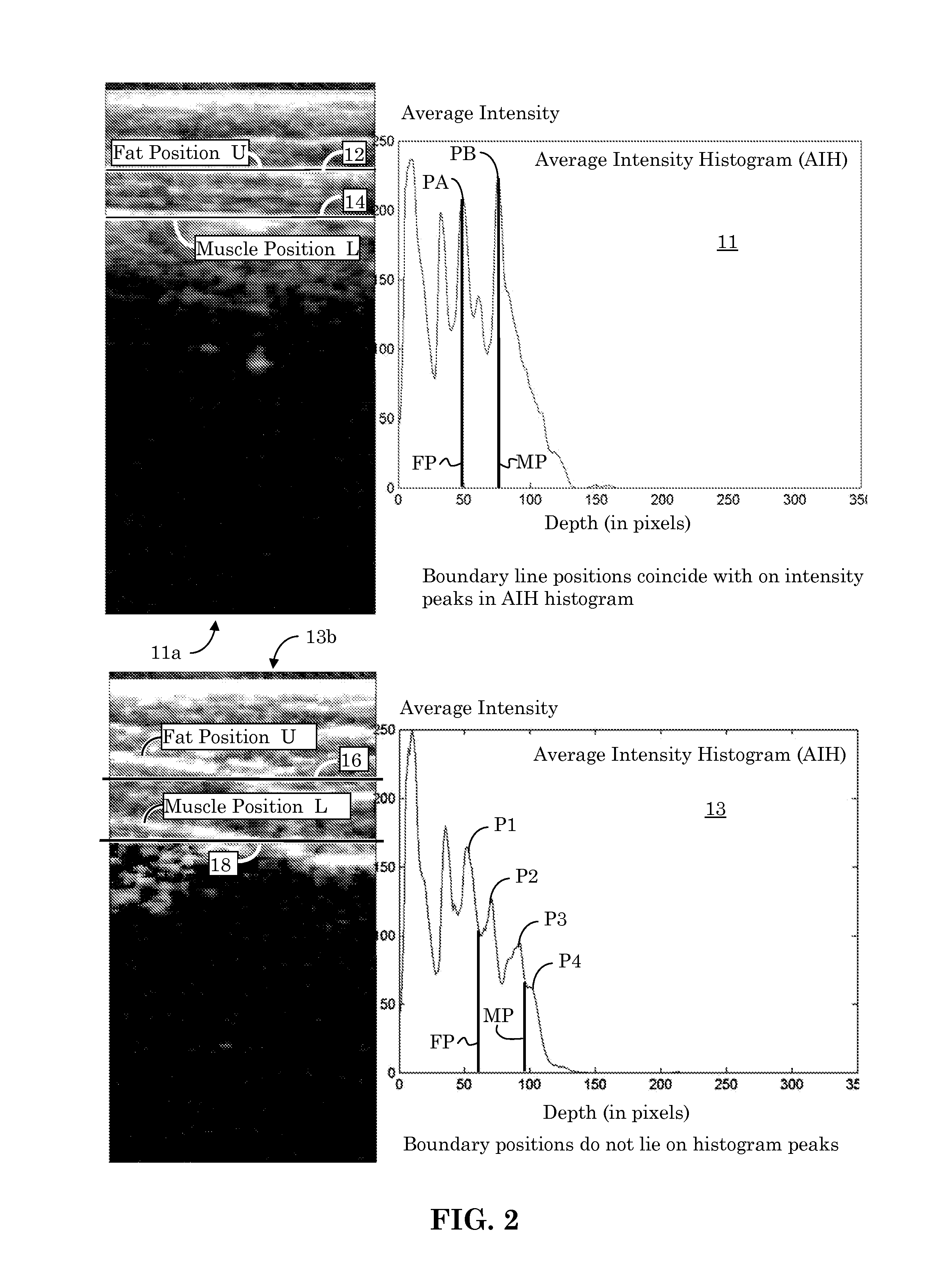 Ultrasound Image Object Boundary Localization by Intensity Histogram Classification Using Relationships Among Boundaries