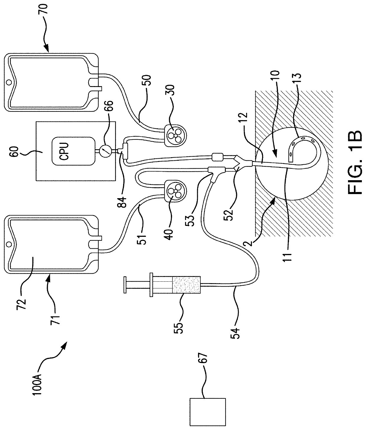 Systems and methods for percutaneous drainage