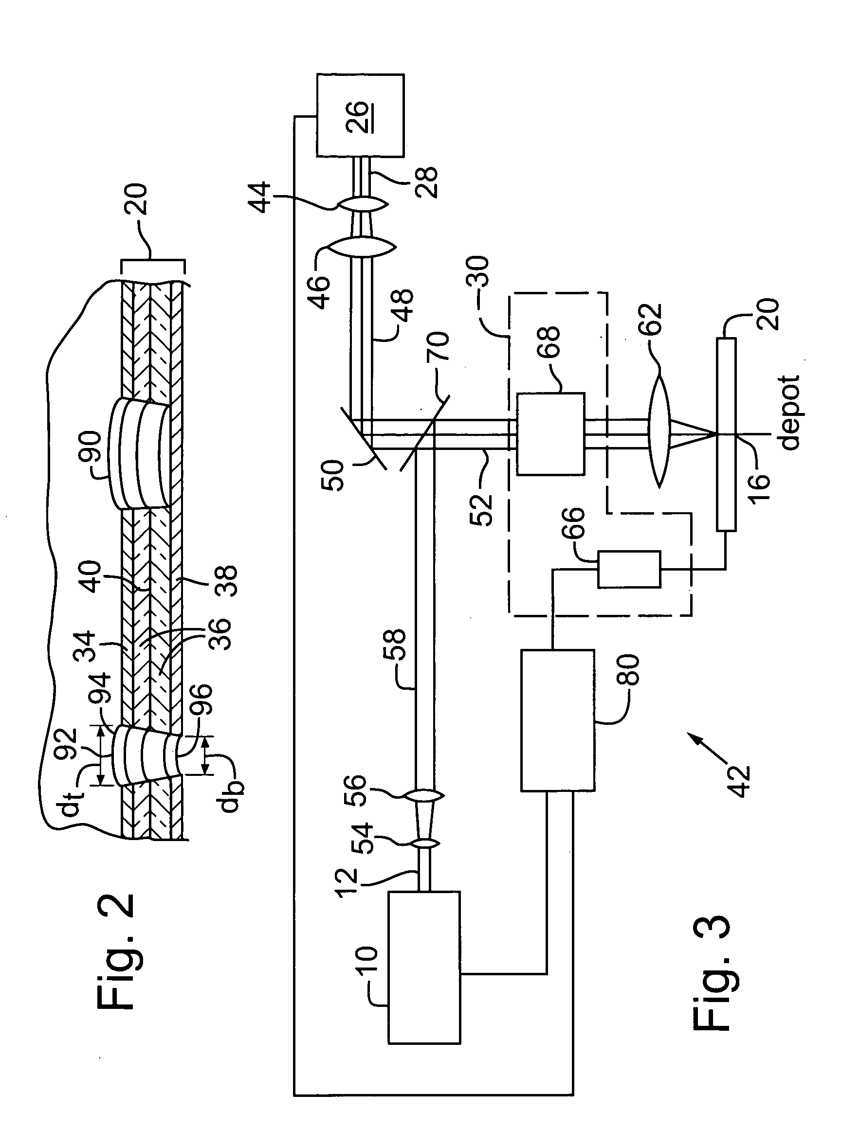 Laser processing of a locally heated target material