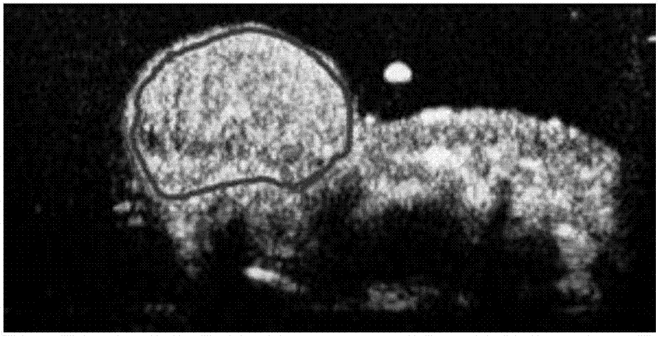 Ultrasound contrast tumor identification method based on multi-mode classifier