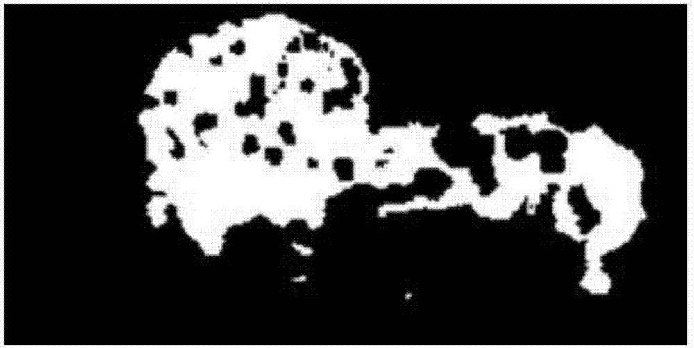 Ultrasound contrast tumor identification method based on multi-mode classifier