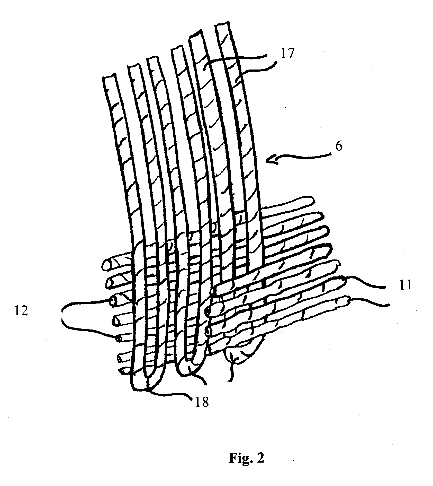 Tire having an improved carcass reinforcement anchoring structure