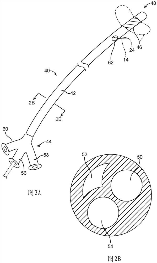 Device, systems and methods for treatment of neurogenic bladder