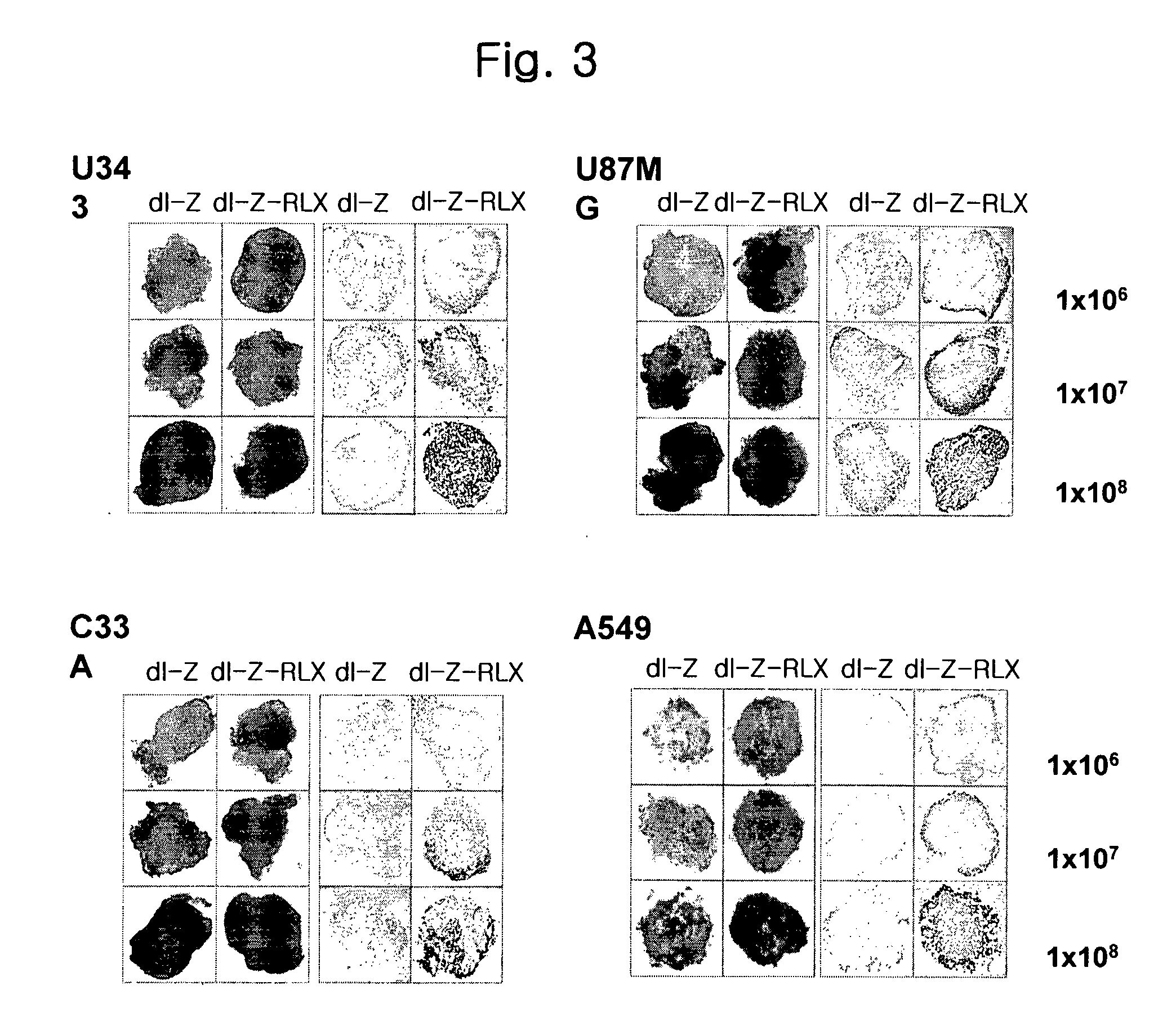 Gene Delivery System Containing Relaxin Gene And Pharmaceutical Composition Using Relaxin