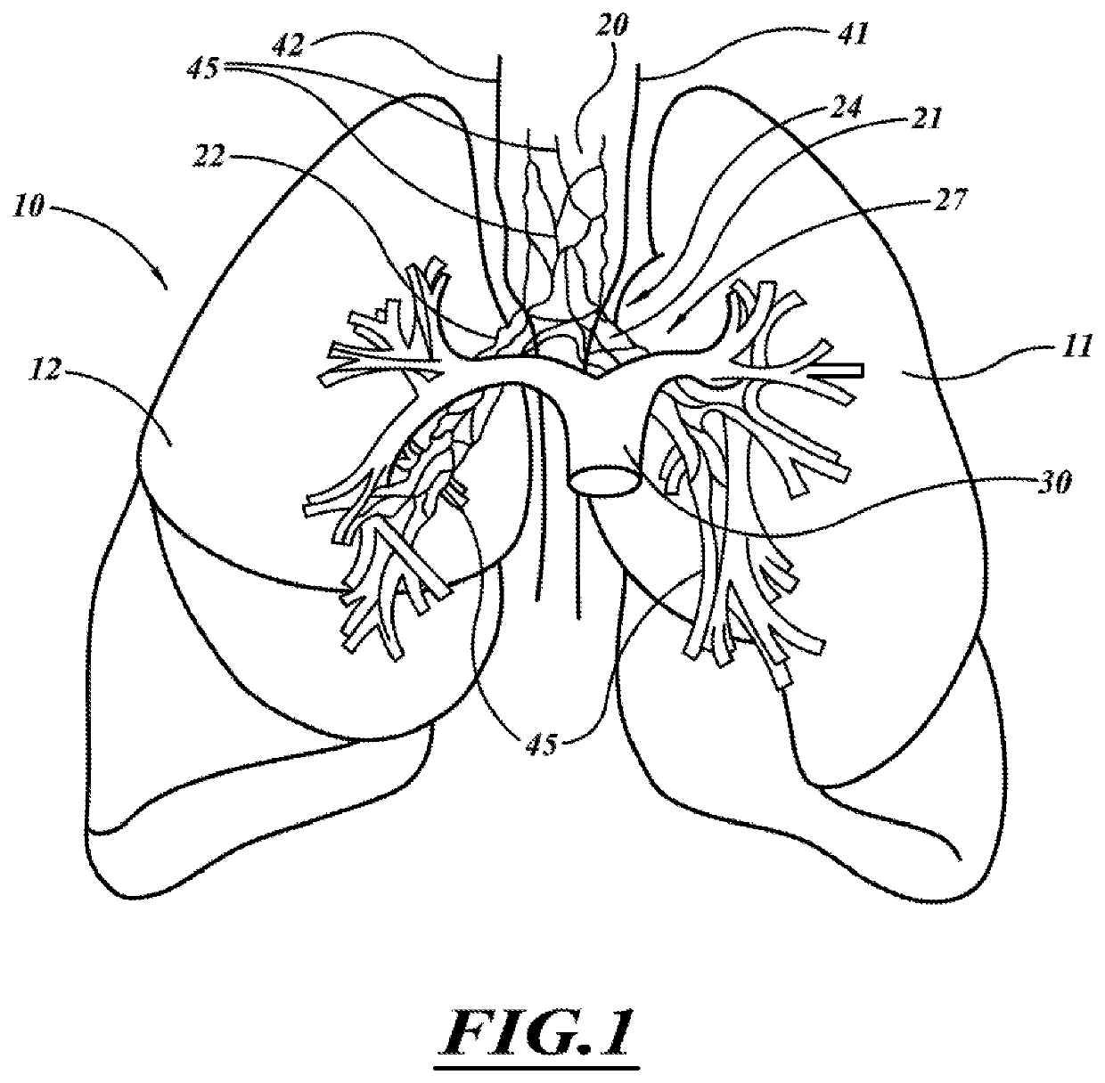 Systems, devices, and methods for treating a pulmonary disease with ultrasound energy