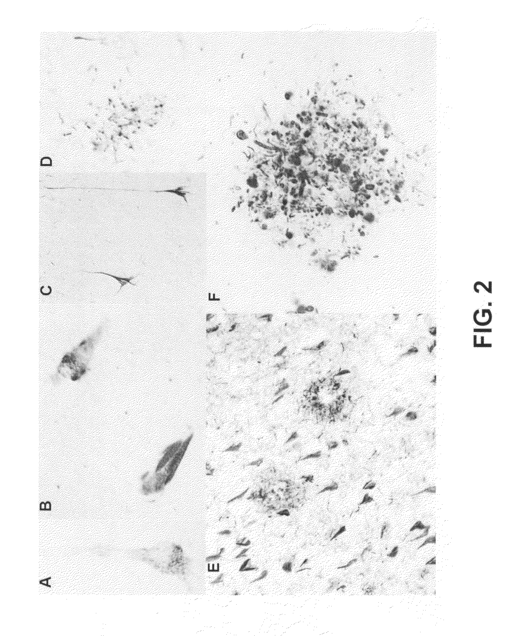 Phosphorylation of tau by abl