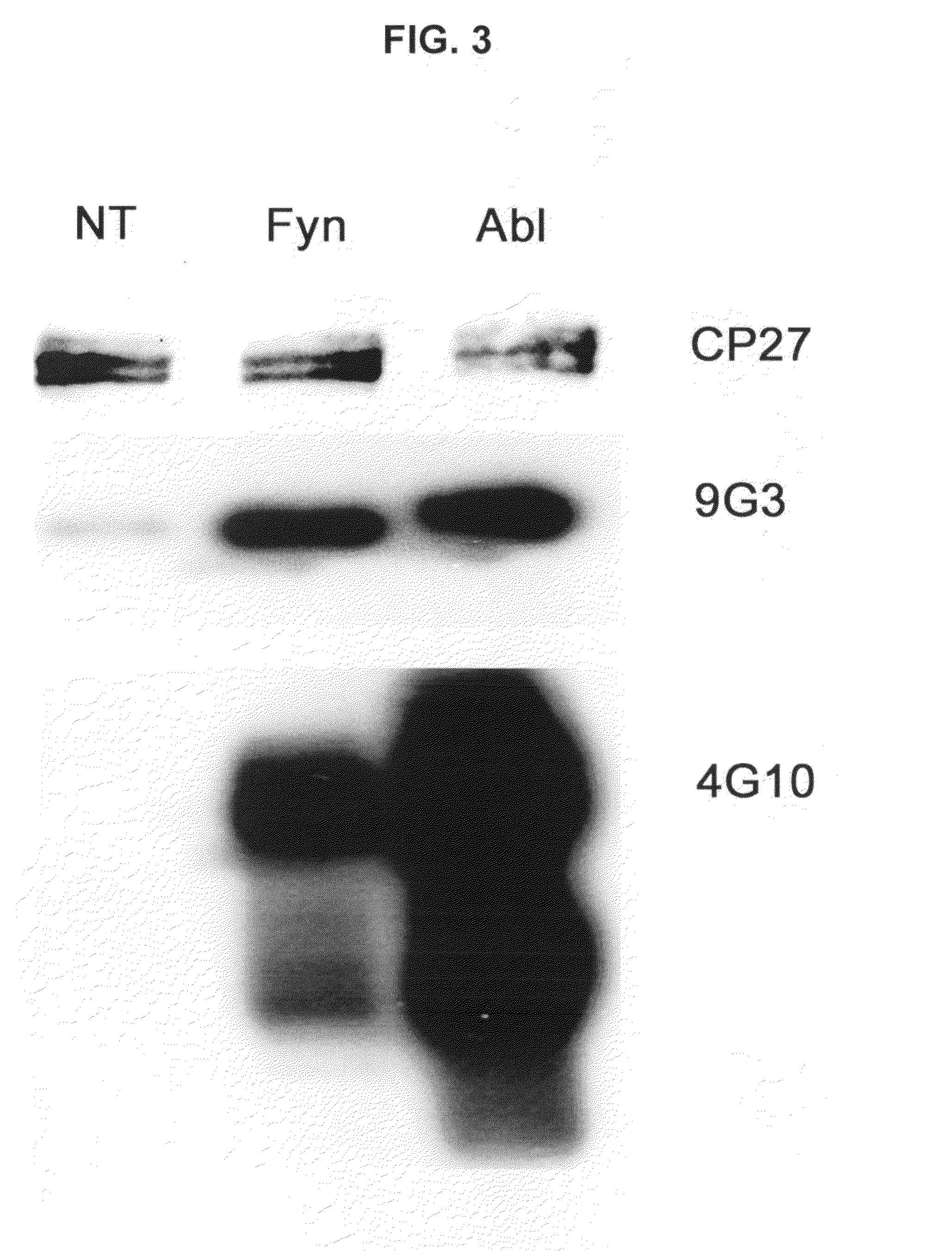 Phosphorylation of tau by abl