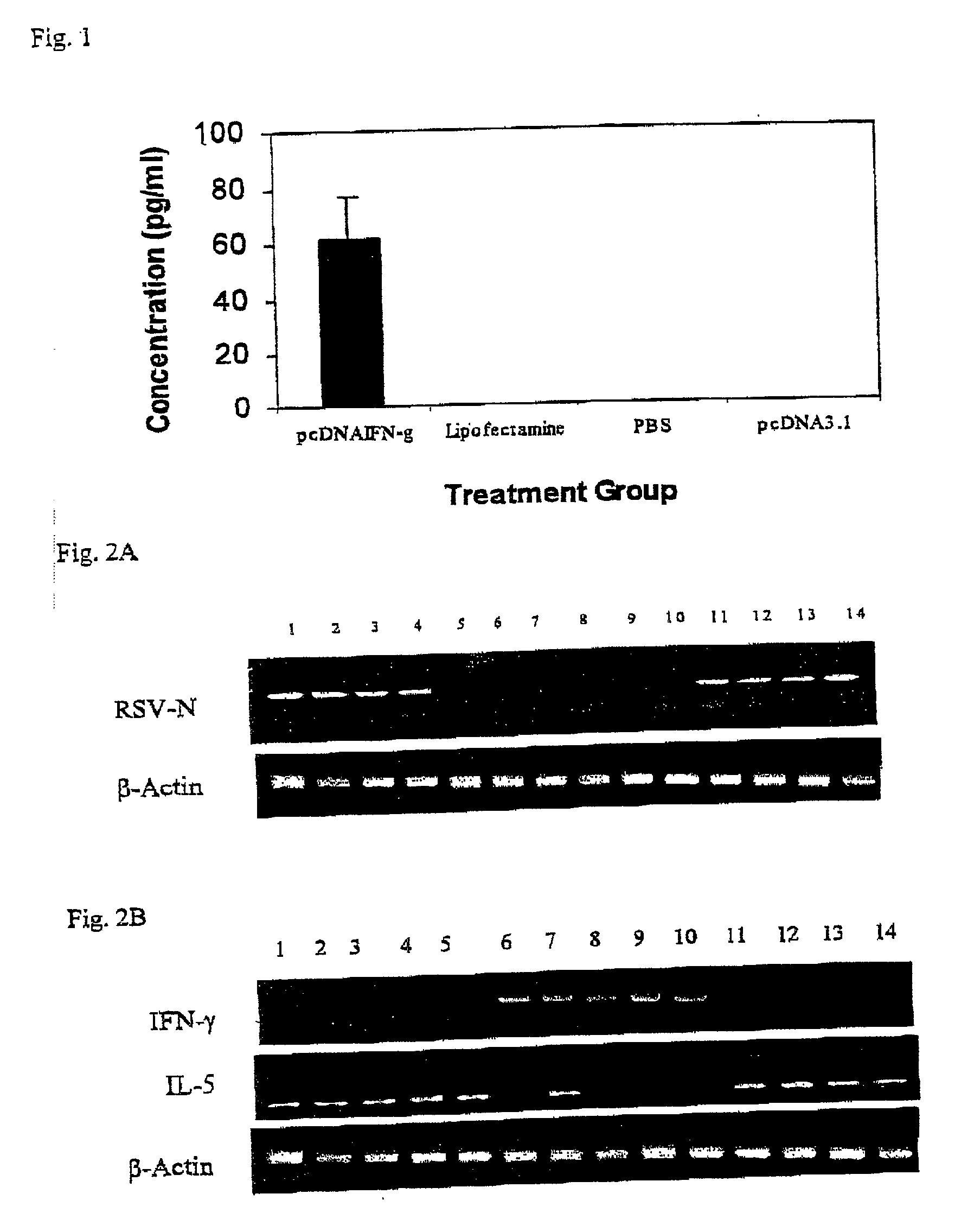 Method of intranasal gene transfer for protection against respiratory infection