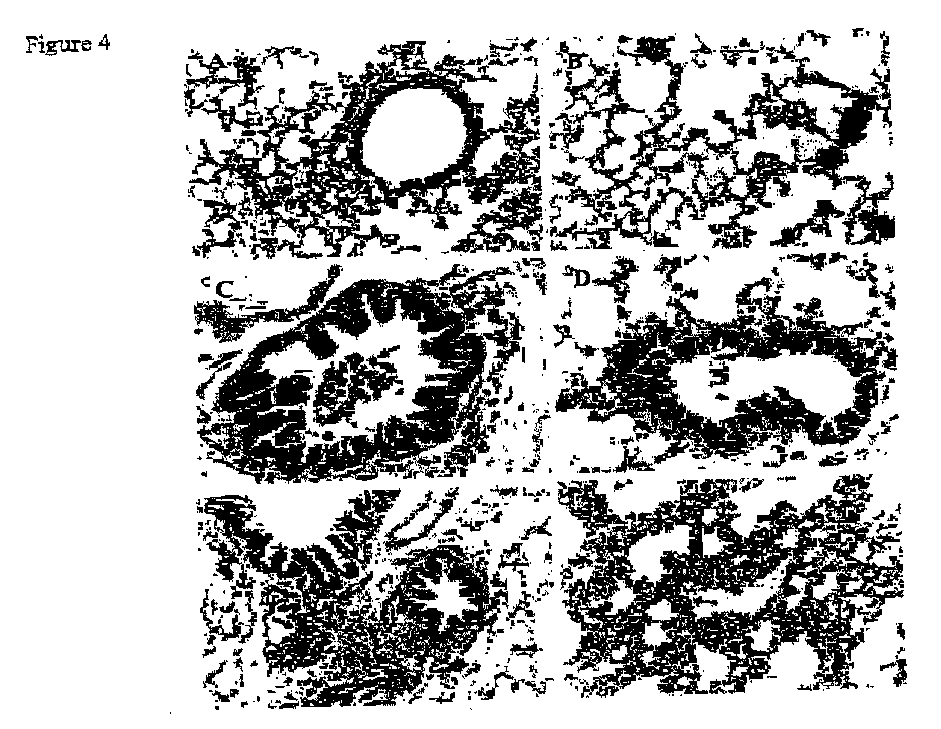 Method of intranasal gene transfer for protection against respiratory infection