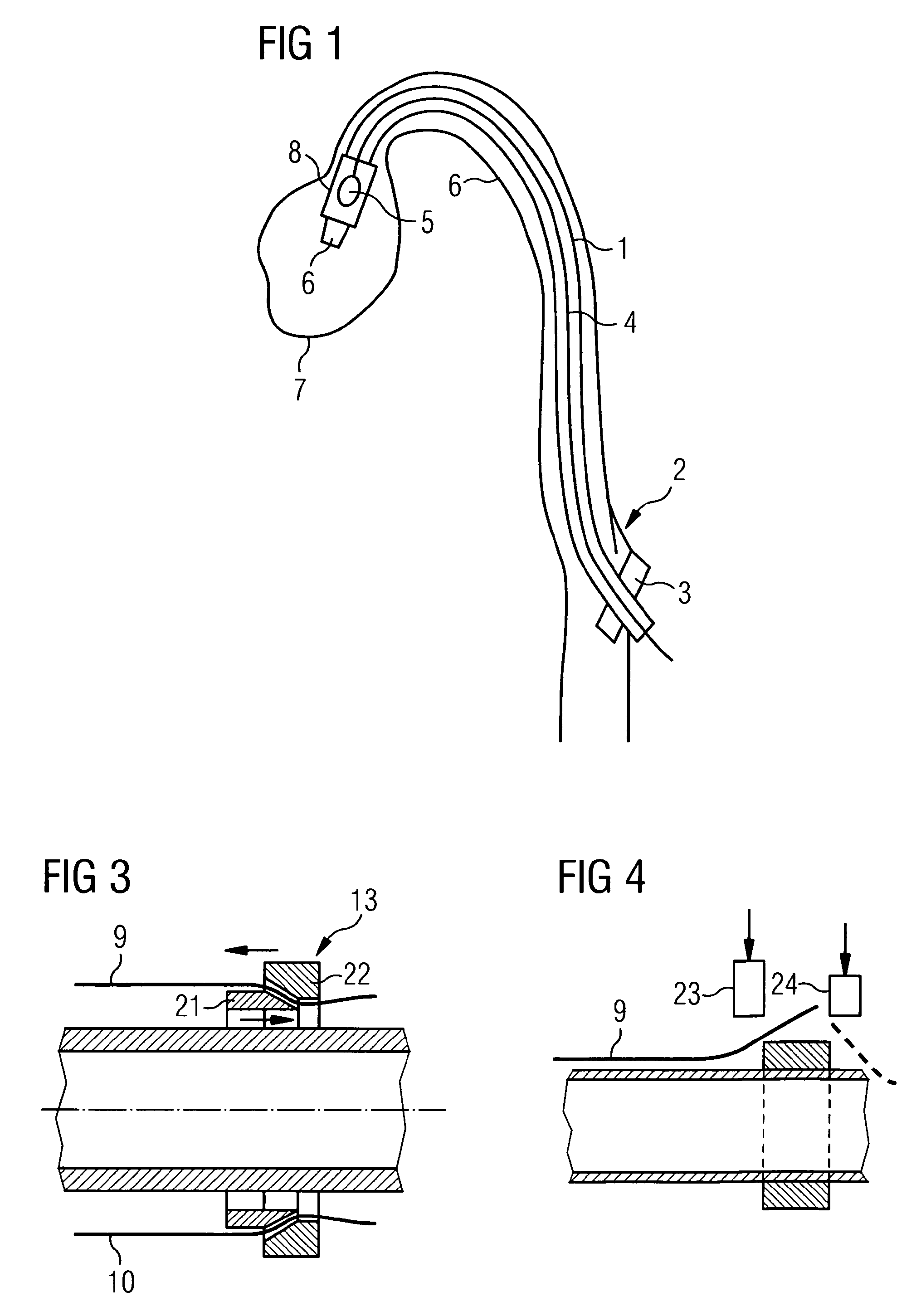 Catheter device having a catheter and an actuation device