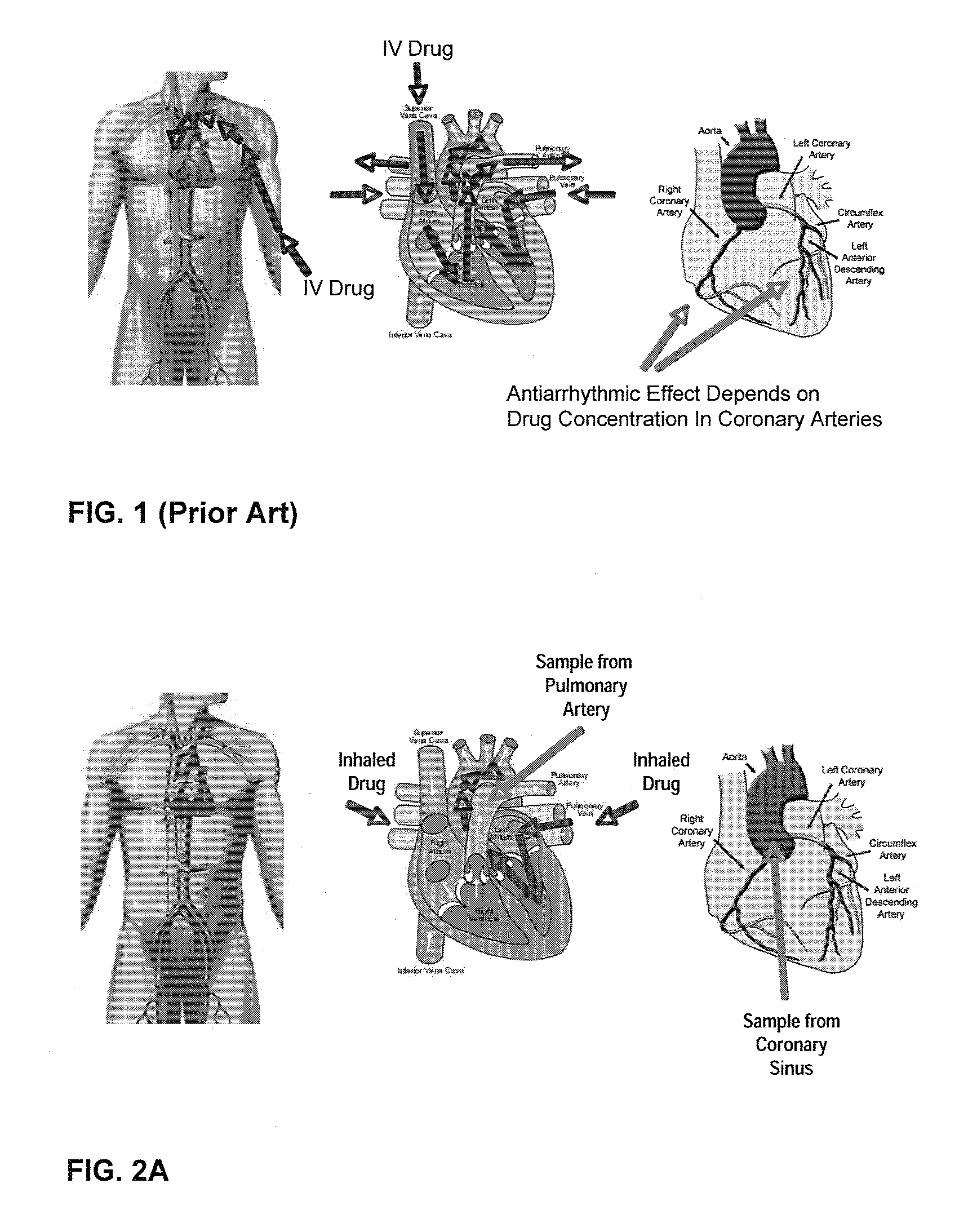 Unit doses, aerosols, kits, and methods for treating heart conditions by pulmonary administration