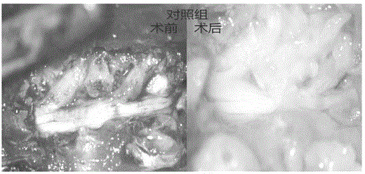 Medicinal injectable anti-adhesive gel and preparation method thereof