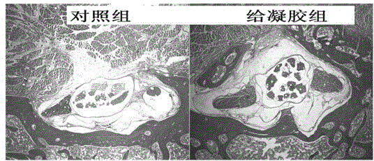 Medicinal injectable anti-adhesive gel and preparation method thereof