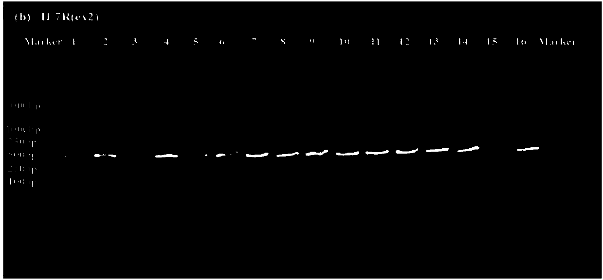 A method and primers for detecting all exons of an IL7R gene