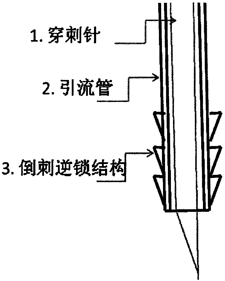 Glaucoma valve drainage device