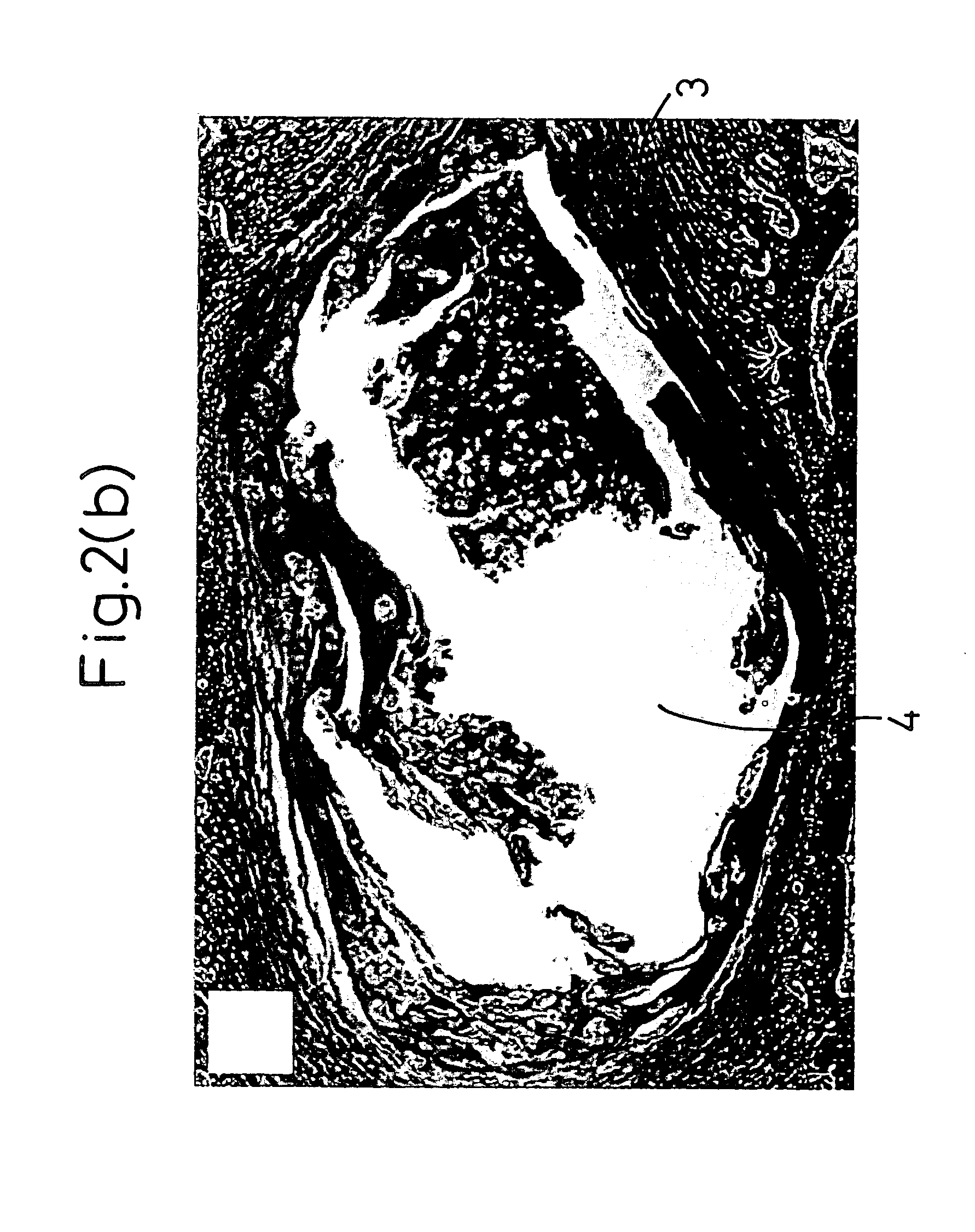 Medium for stem cells to be used in intervertebral disk generation and regeneration of intervertebral disk using stem cells