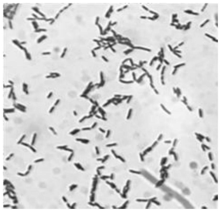 Lactobacillus gasseri LS03 and application thereof