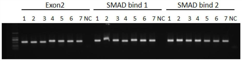 GRNA of targeted CTGF gene and application thereof