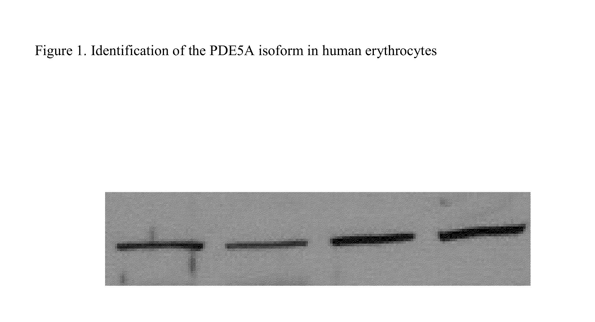 Method of identifying therapies for pulmonary hypertension