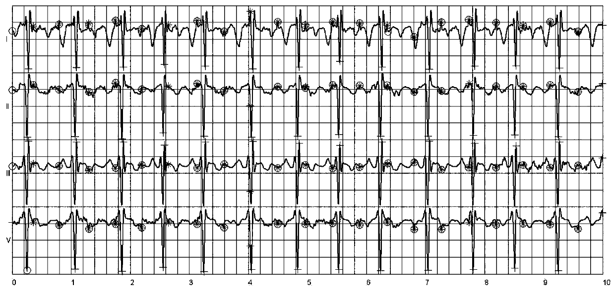 An intelligent terminal for extracting fetal heart rate