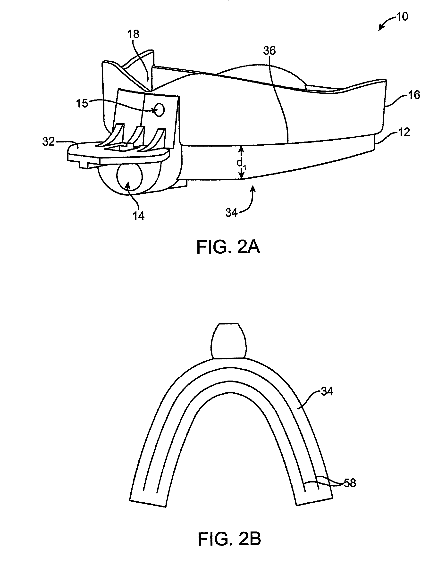 Injection impression tray