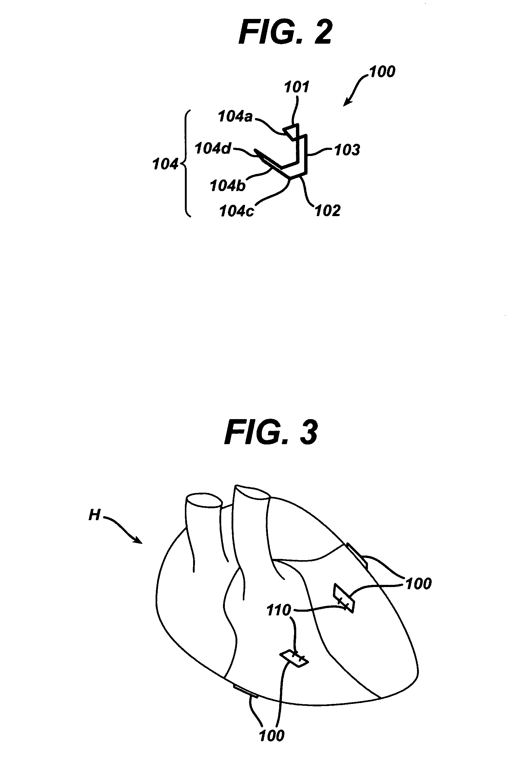 Systems and methods for assisting cardiac valve coaptation