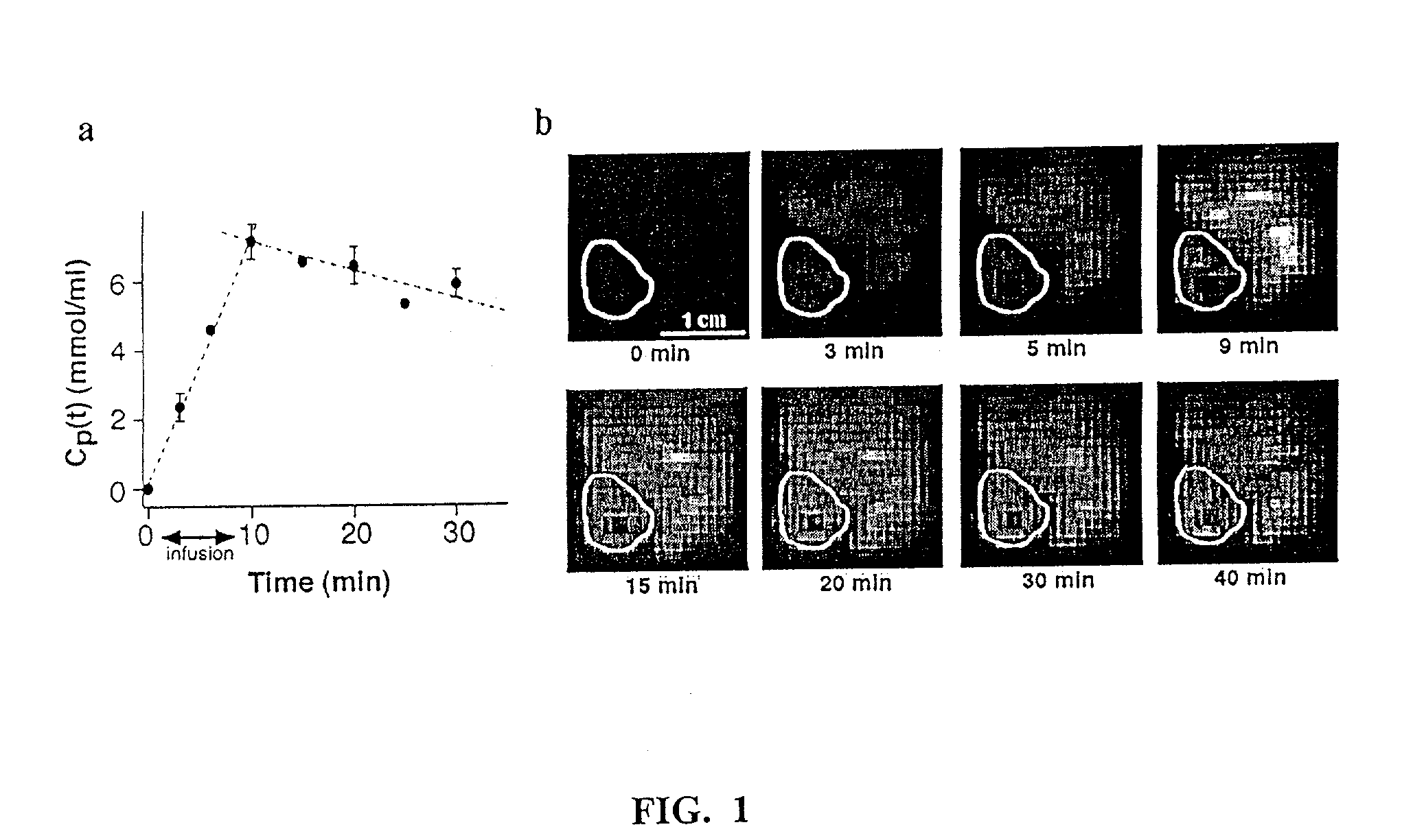 Method and apparatus for monitoring and quantitatively evaluating tumor perfusion