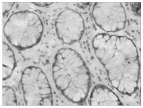 tk1 antibody, kit and use thereof