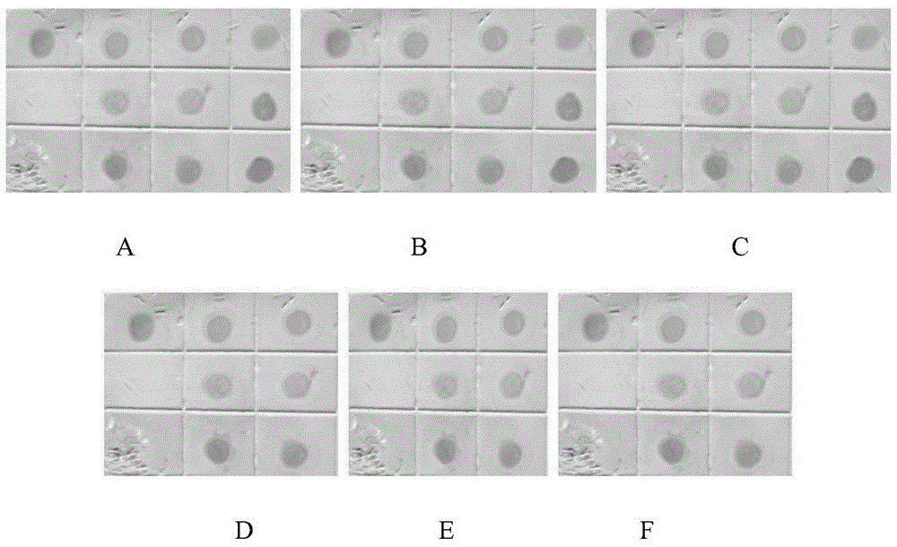 Recombinant human interferon beta-1b freeze-dried preparation and preparing method thereof