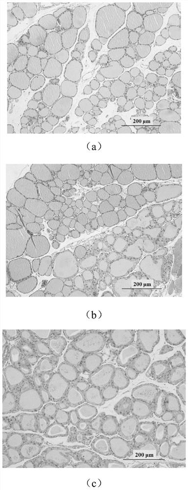 Application of total glucosides of paeony in preparation of medicine for treating Graves disease